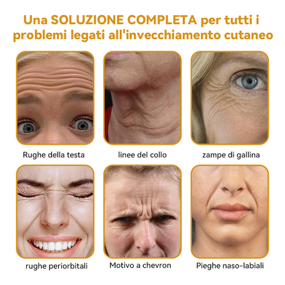 Prodotto e spedito dall'Italia 🏆AWZLOVE® Crema completa al veleno d'api ULTIMO GIORNO 80% DI SCONTO🏆