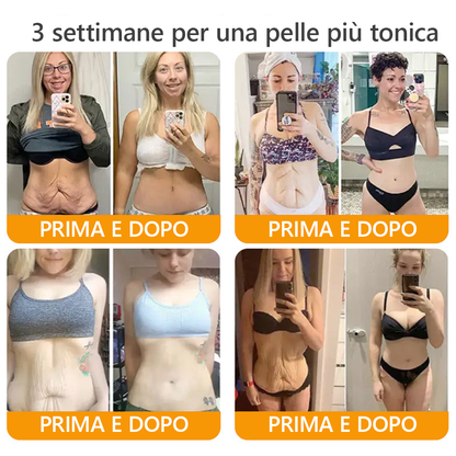 Prodotto e spedito dall'Italia 🏆AWZLOVE® Crema completa al veleno d'api ULTIMO GIORNO 80% DI SCONTO🏆