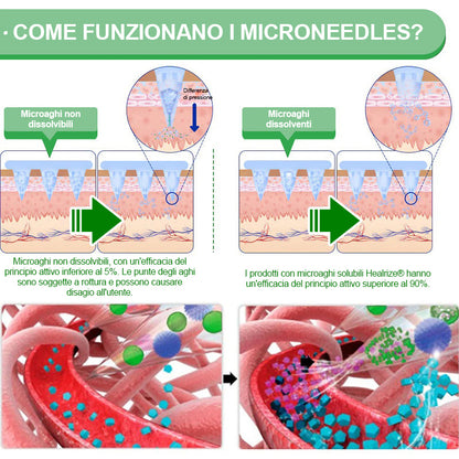Negozio Ufficiale👩‍⚕️| H𝐞a𝐥r𝐢z𝐞® 12-IN-1 Morin𝑎 * B𝐞r𝐛e𝐫i𝐧e * N𝐀D+ Avanzato Nano Micronedle Patch (Un'applicazione giornaliera, cambiamenti visibili in 7 giorni) 🎖️ Per obesità, pelle cadente, diabete, apnee notturne, e problemi articolari 🎖️