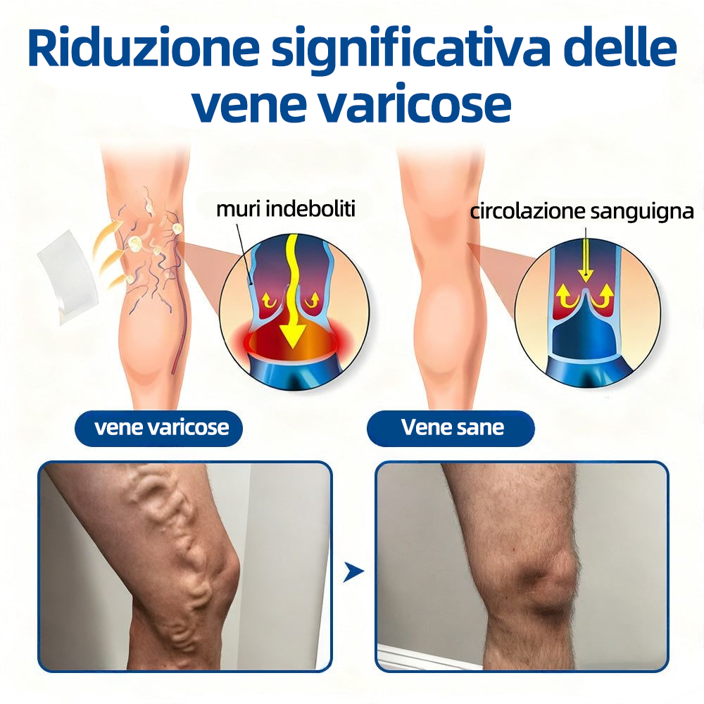 Healrize® VeinTarget Patch Microneedle  Sollievo Immediato, Risultati a Lungo Termine🏃‍♂️‍➡️🏃‍♂️‍➡️2
