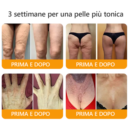 Prodotto e spedito dall'Italia 🏆AWZLOVE® Crema completa al veleno d'api ULTIMO GIORNO 80% DI SCONTO🏆