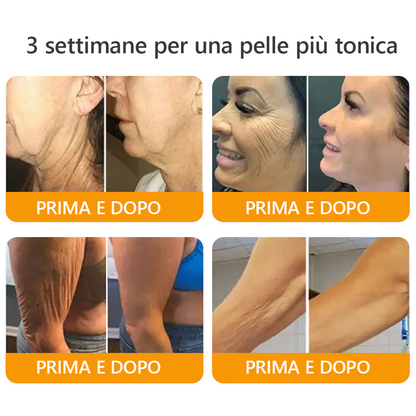 Prodotto e spedito dall'Italia 🏆AWZLOVE® Crema completa al veleno d'api ULTIMO GIORNO 80% DI SCONTO🏆